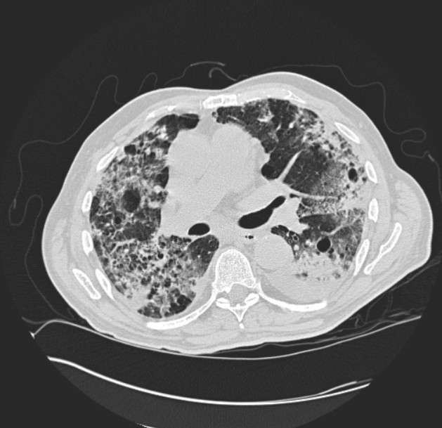 A DICOM image slice